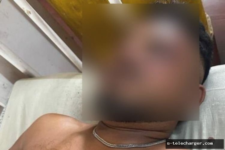 Korban Selamat Air India Duduk di Dekat Pintu Darurat, Ini Kesaksiannya Selamat dari Ledakan